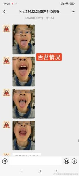 嘴巴动了动是什么意思_嘴巴动了动暗示什么