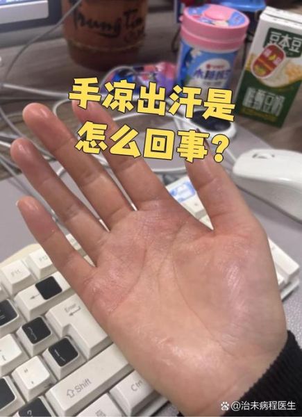 小手冰凉是怎么回事_小手经常出汗怎么办