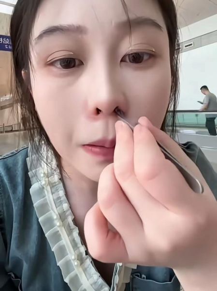 鼻子小怎么办_鼻子小会影响呼吸吗