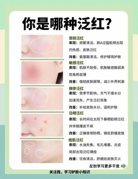脸通红是什么原因_脸通红怎么快速缓解