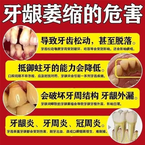 牙齿松动怎么办_牙齿疼痛吃什么药