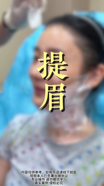 眉毛上扬代表什么情绪_眉毛下垂怎么改善