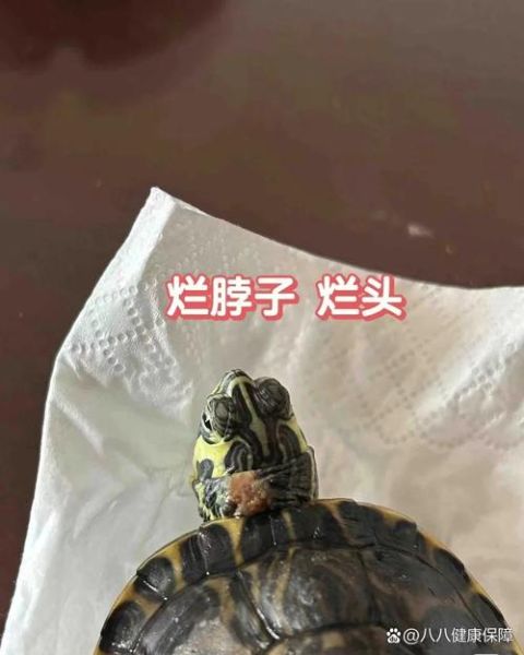 烂皮是什么_烂皮怎么治疗