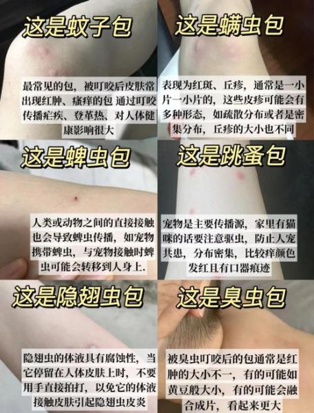 什么虫子会咬人_被虫子咬了怎么办