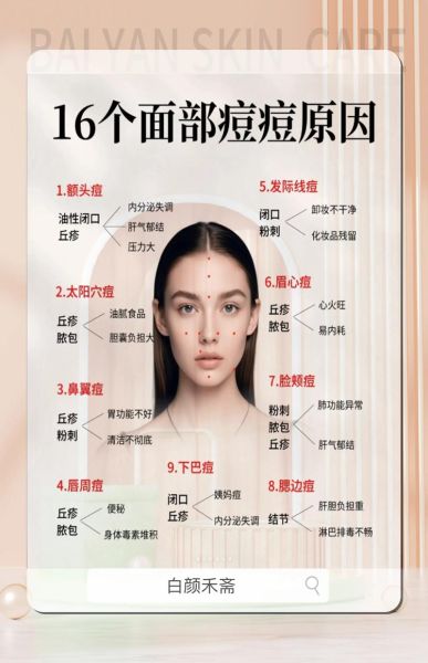 脸上长痘痘是什么原因_脸上长痘痘怎么快速消除