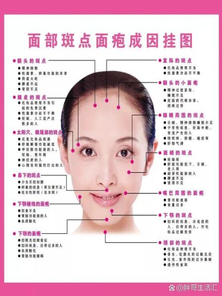 脸上长痘痘是什么原因_脸上长痘痘怎么快速消除