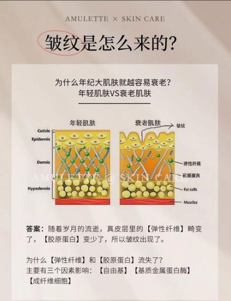 皱纹是怎么形成的_如何淡化皱纹最有效