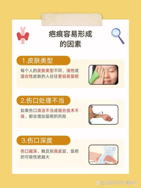 小伤口怎么处理不留疤_小伤口几天能好