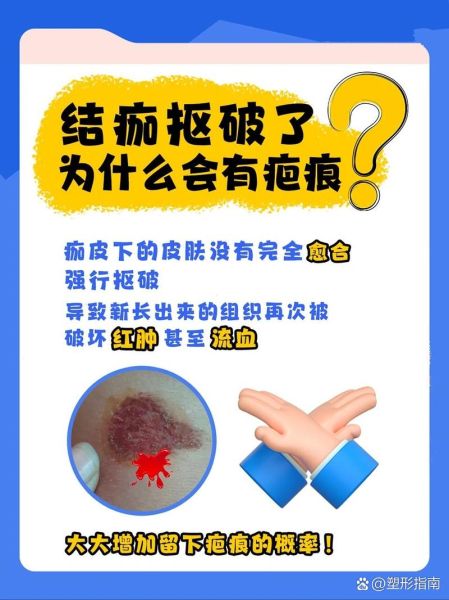 小伤口怎么处理不留疤_小伤口几天能好