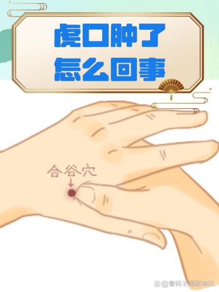 虎口有疤会影响运势吗_虎口疤痕的命理解析