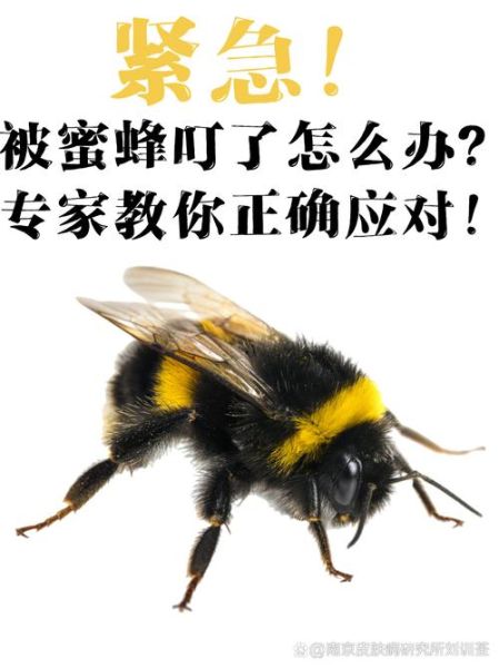 蜂子蛰运势_被蜂蛰了是吉是凶
