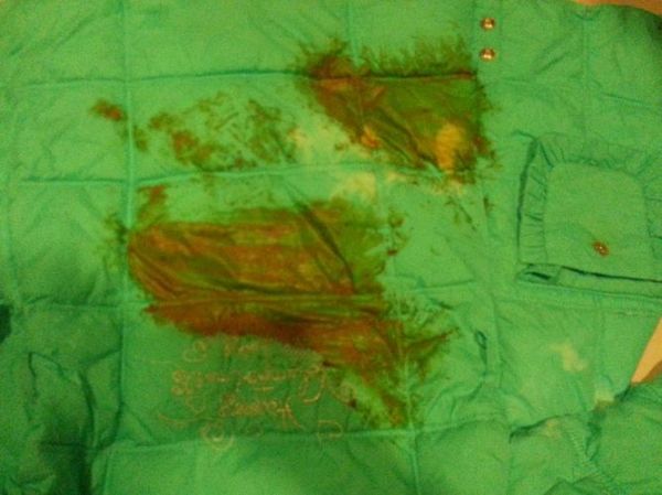 梦到衣服沾屎是什么意思_如何化解