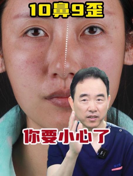 梦见鼻子歪了_是什么预兆