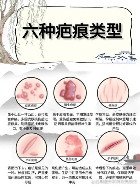 疤痕会影响运势吗_如何化解疤痕带来的霉运