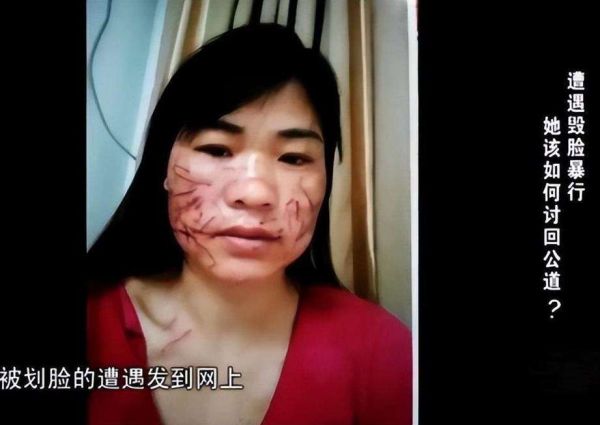 梦到脸被割伤_预示什么