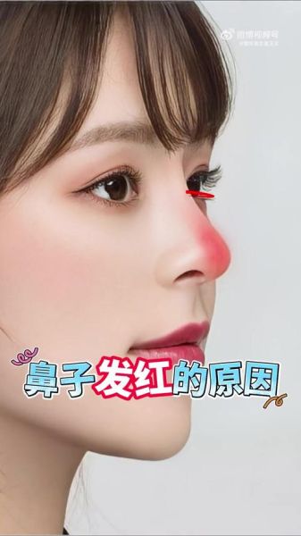 隆鼻会影响运势吗_隆鼻后运气真的会变好吗