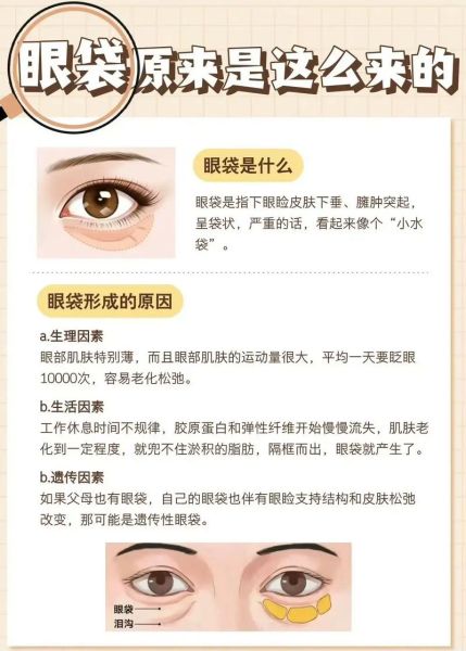 眼袋影响财运吗_眼袋与财富的关系