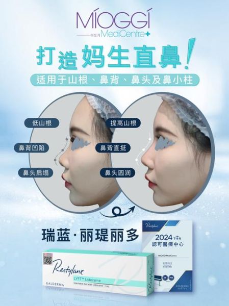 鼻子塌会影响财运吗_如何改善鼻子塌带来的财运阻碍