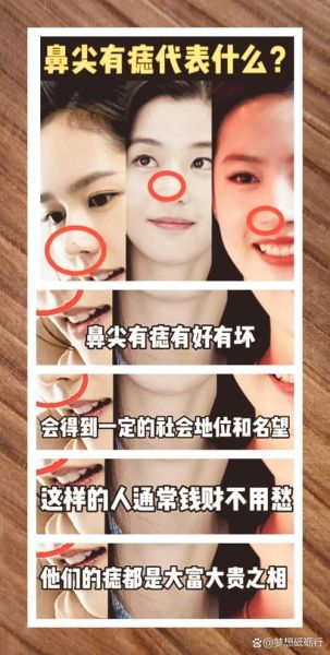 鼻子财运怎么看_鼻子塌会影响财运吗