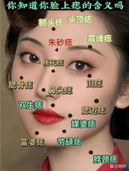 脸上黑星子影响财运吗_如何化解