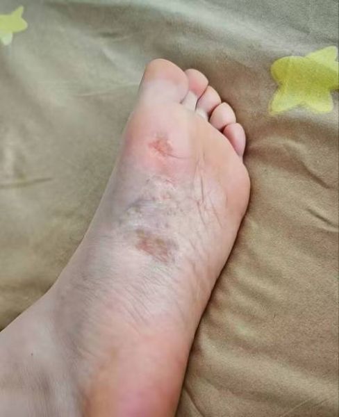 梦到脚很脏是什么意思_如何化解