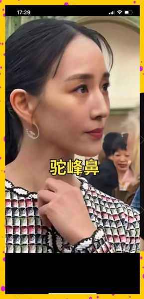 驼峰鼻影响财运吗_驼峰鼻怎么改运