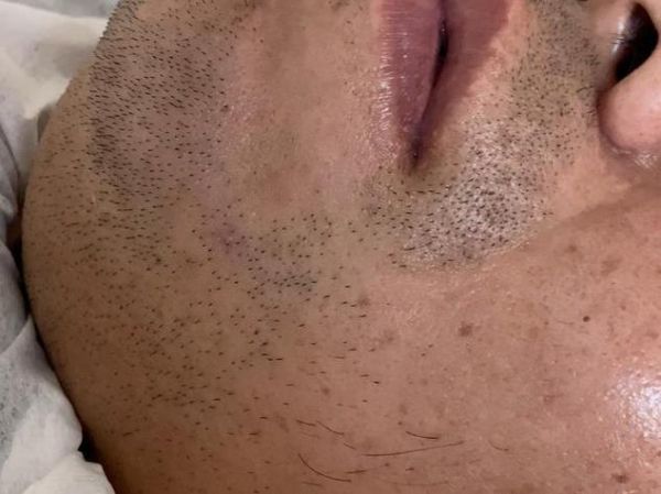 梦见胡子很长_意味着什么