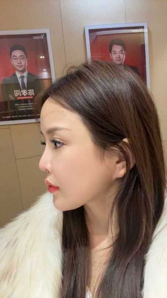 鼻子整形会改变财运吗_隆鼻后真的招财吗