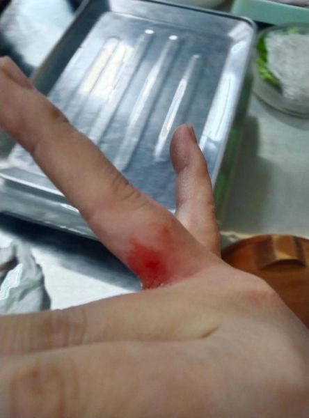 梦到手出血_手出血梦境预示什么