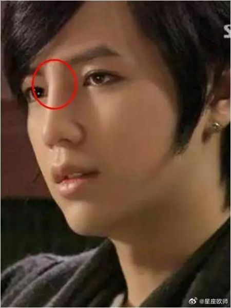 动了山根会影响运势吗_山根整形与面相学关系