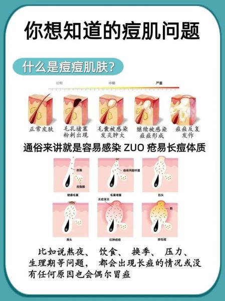 梦到脸上长痘痘_怎么办