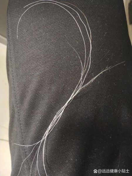 梦到自己长了很多白头发_意味着什么