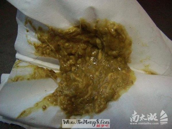 梦到男孩拉屎到我身上_周公解梦