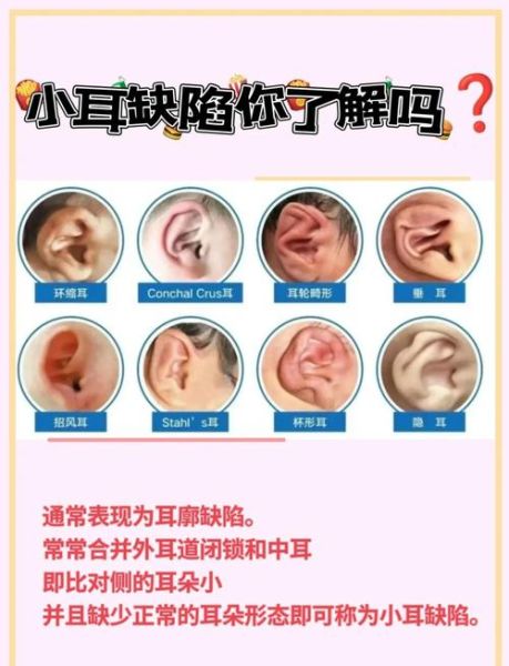 耳小会影响财运吗_耳小的人如何招财改运