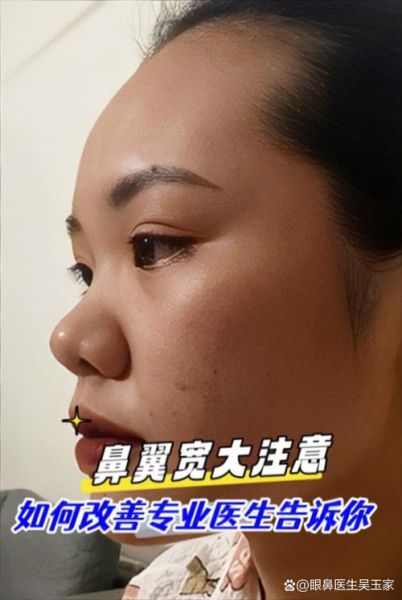 鼻翼宽大财运好吗_鼻翼小是不是没钱