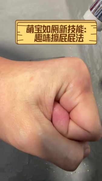 梦到擦屁股手上沾屎_意味着什么