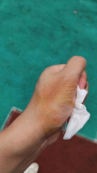 梦到猫抓人_是什么意思