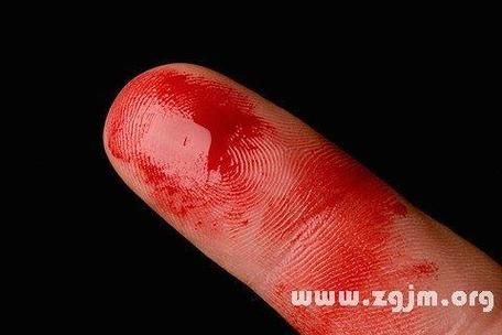 梦到割手是什么意思_梦到割手预示什么