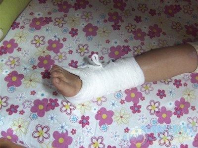 梦到脚断了_是什么预兆