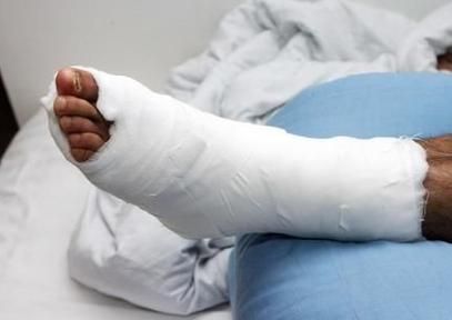 梦见骨折财运_梦见骨折是破财还是发财