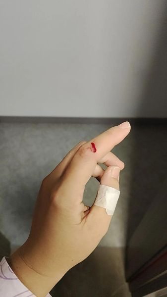 梦到女儿手受伤_意味着什么