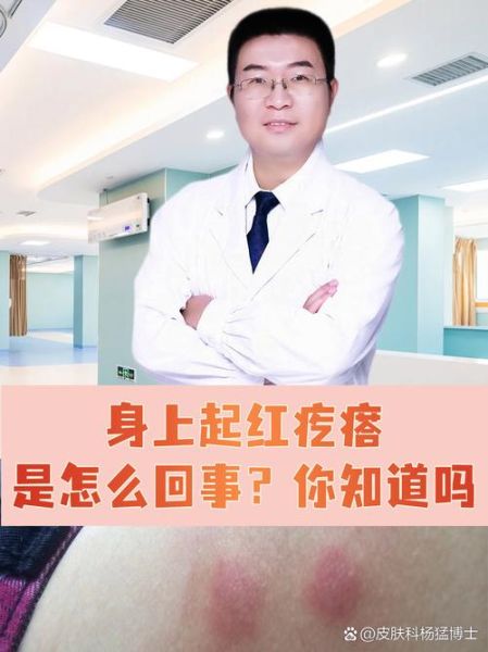 梦到红疙瘩是什么意思_梦到红疙瘩预示什么