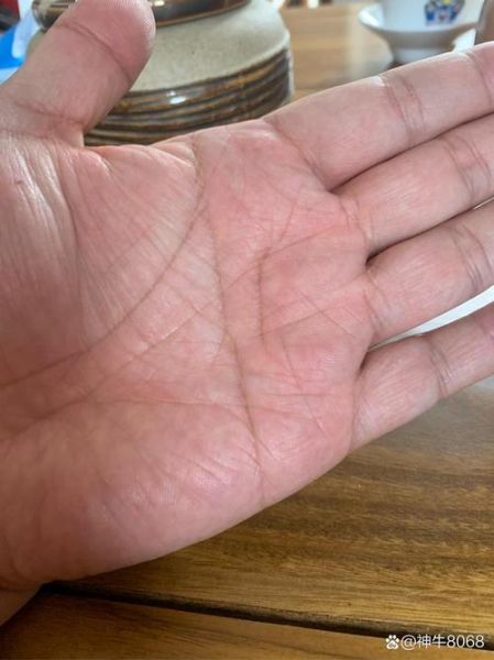 横财运断掌怎么看_断掌横财运是真的吗