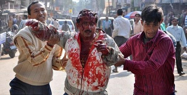 梦到被豹子咬伤是什么意思_被豹子咬伤的梦境解析