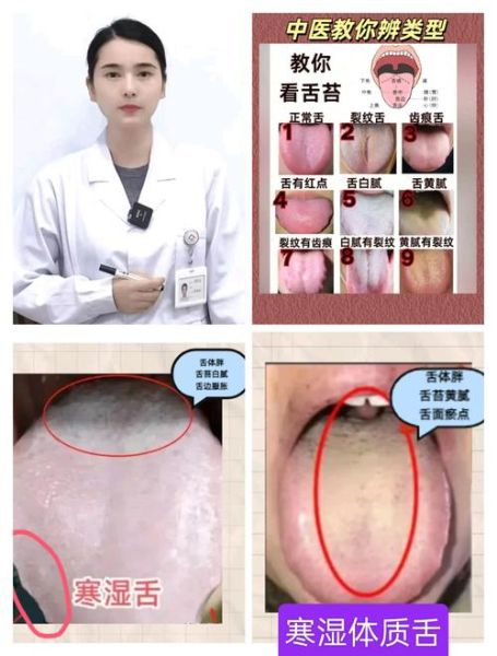 梦到舌头_舌头断了代表什么