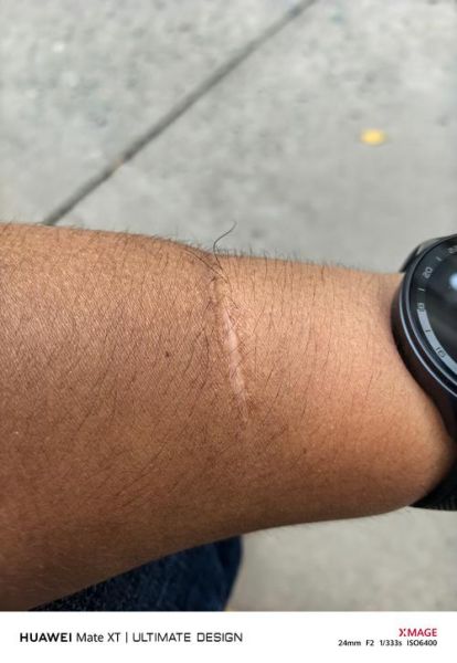 梦到自己被砍伤_是什么意思