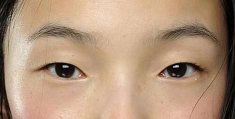 上眼皮厚的人财运如何_上眼皮厚是富贵相吗