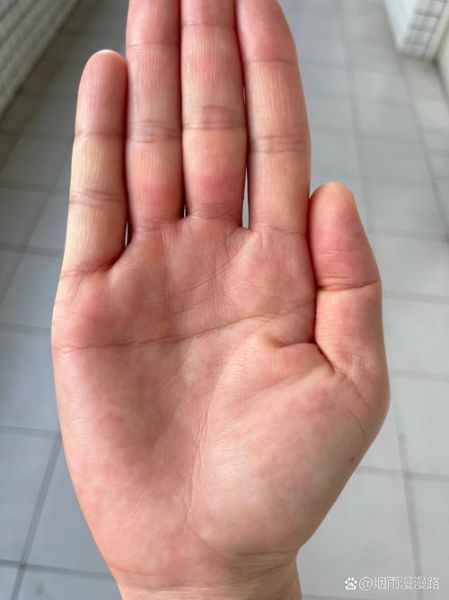 断掌右手财运_右手断掌真的会发财吗