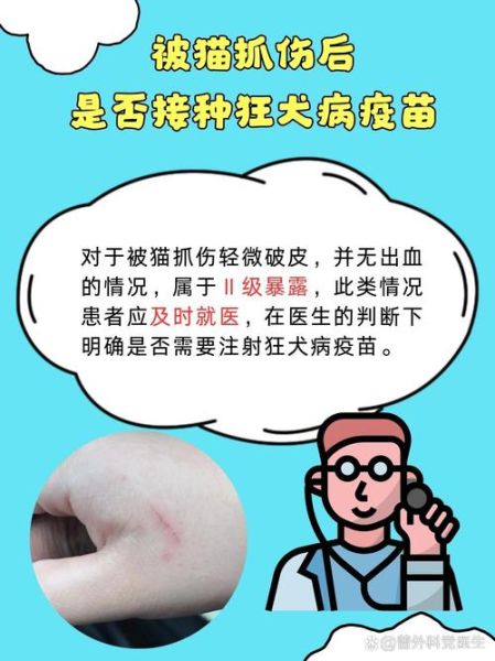 梦到被猫抓是什么意思_如何化解