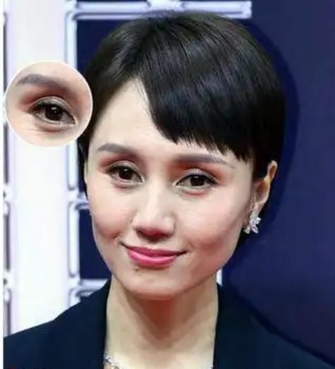 眼窝凹陷财运好吗_眼窝凹陷面相解析